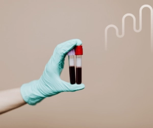 A gloved hand holds two blood-filled test tubes against a beige background, with a subtle white graph design, conveying a clinical, professional tone.
