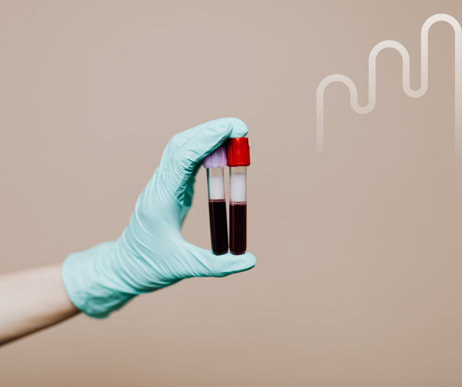 A gloved hand holds two blood-filled test tubes against a beige background, with a subtle white graph design, conveying a clinical, professional tone.